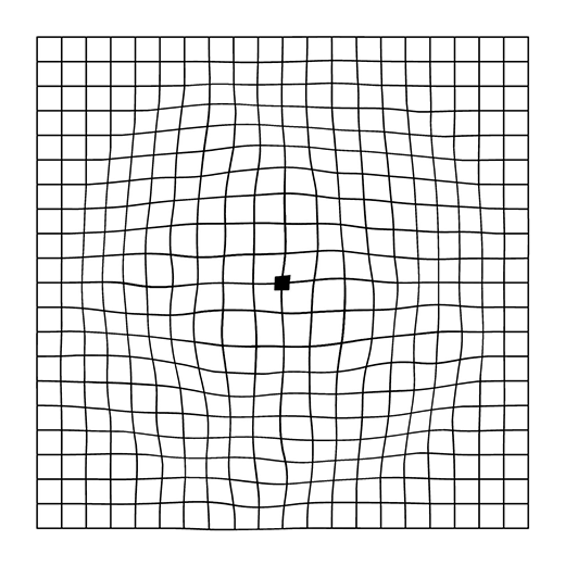 Overlay Illustration